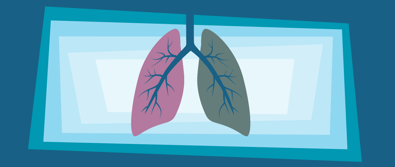 HRAs Build Intrinsic Motivation for Lung Screenings All Year Long